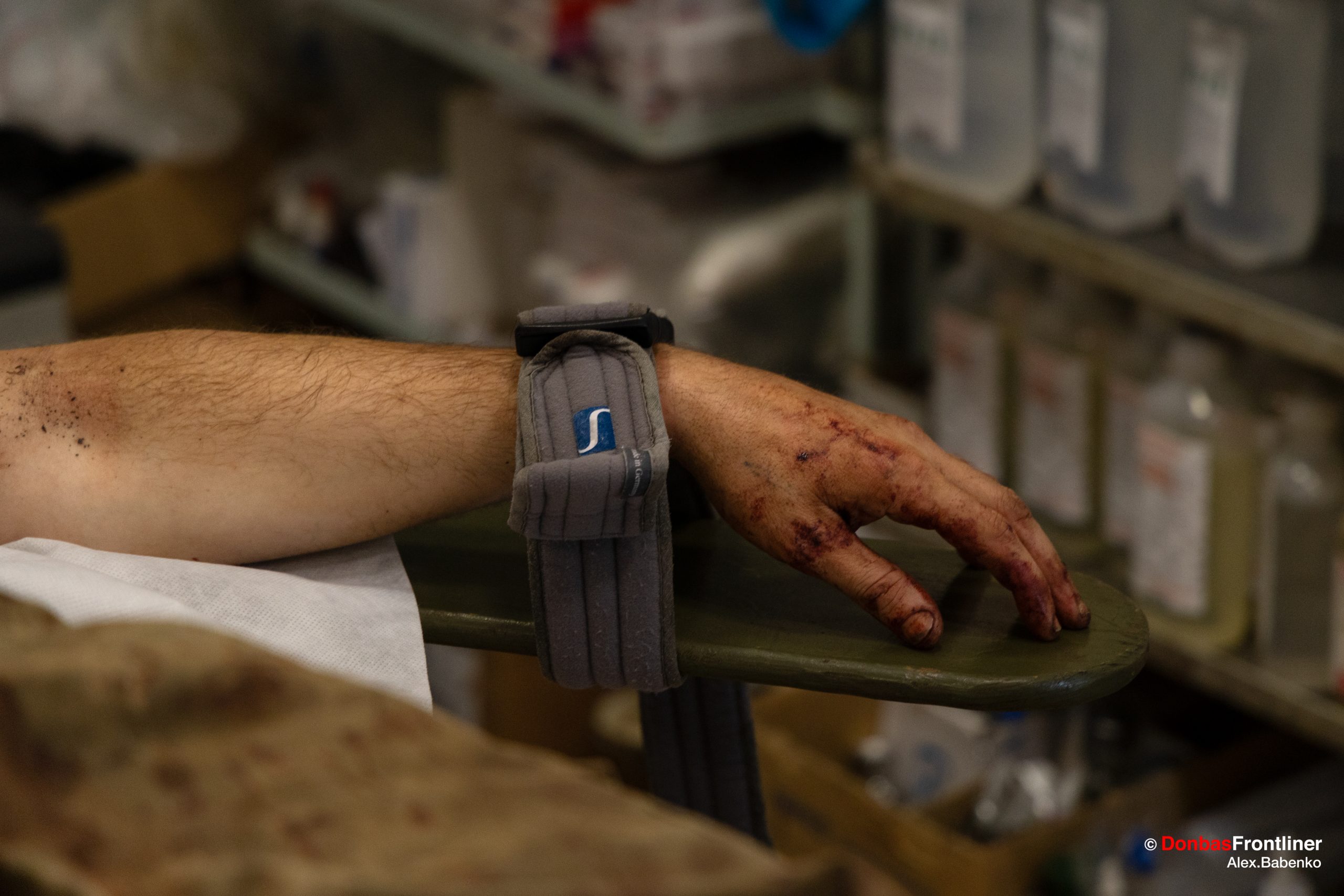 Donbas Frontliner / Рука пораненого бійця, який щойно потрапив на стабілізаційний пункт