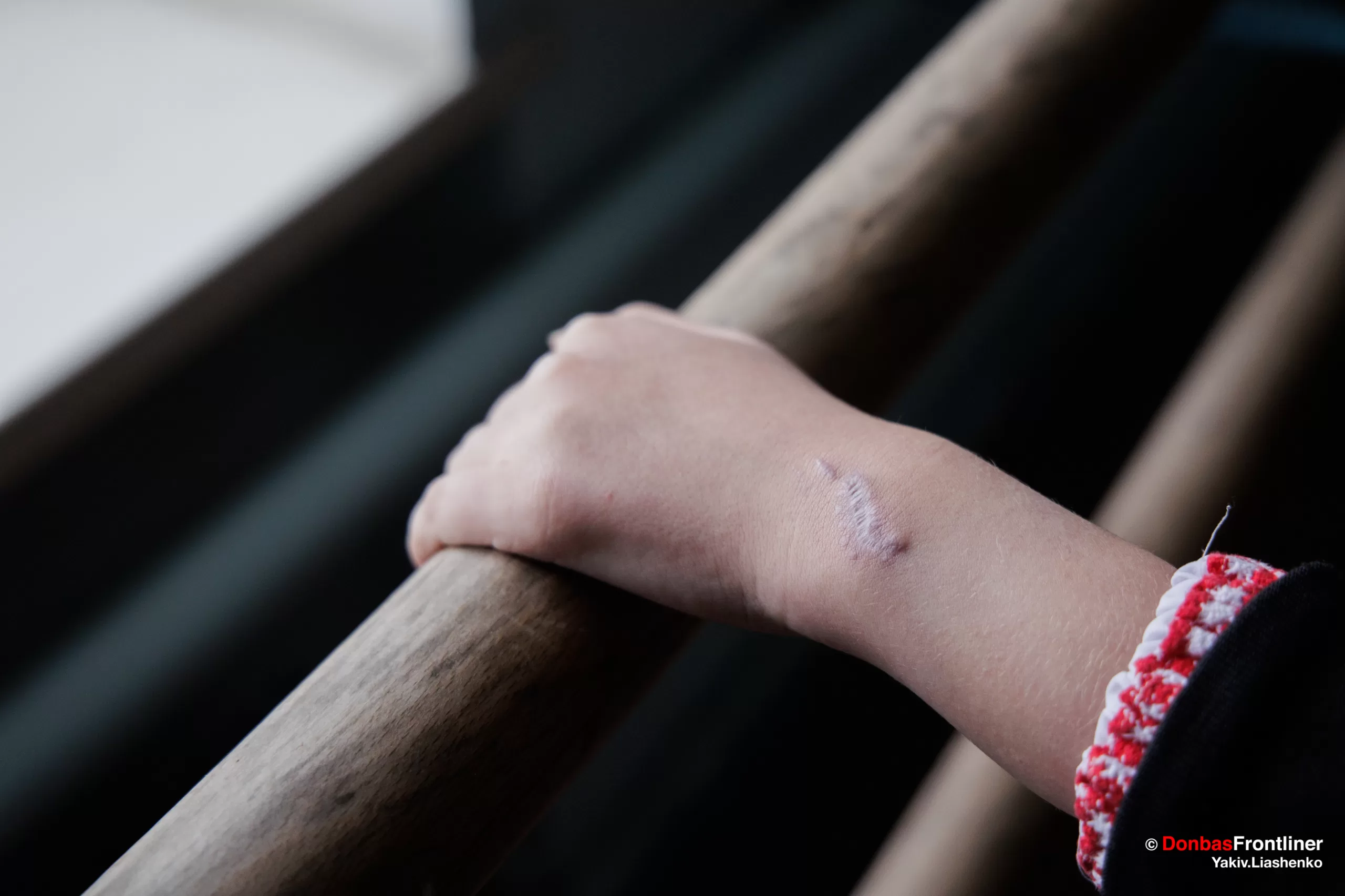 Donbas Frontliner / Уламки порізали дівчині руки і зачепили обличчя.